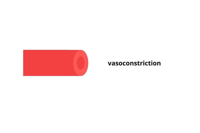 vasoconstriction