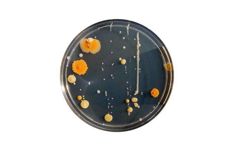 bacteria and fungi