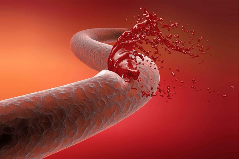 Damage to small blood vessels and tissues