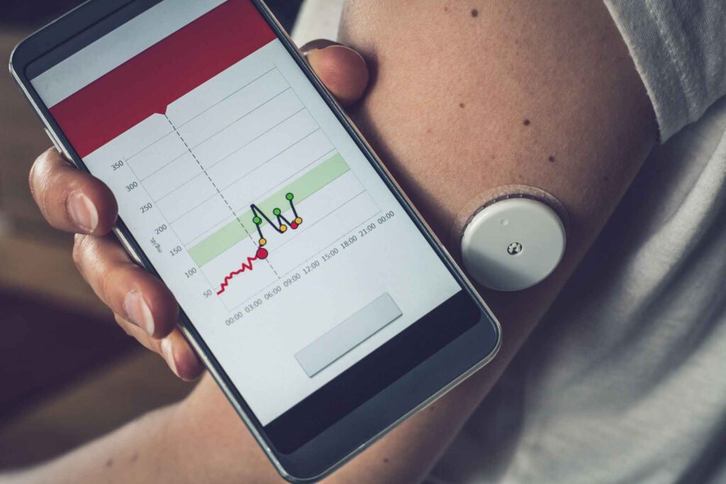 Smart phone with chart of glucose level