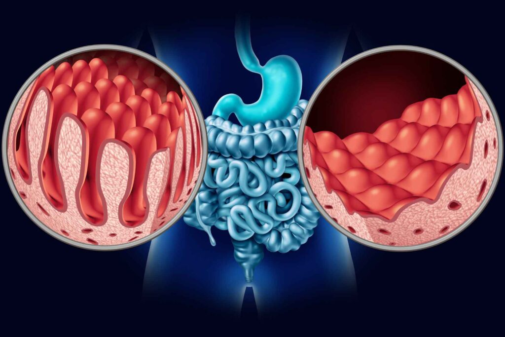 Stomach, intestine (zoomed) computer art graphic