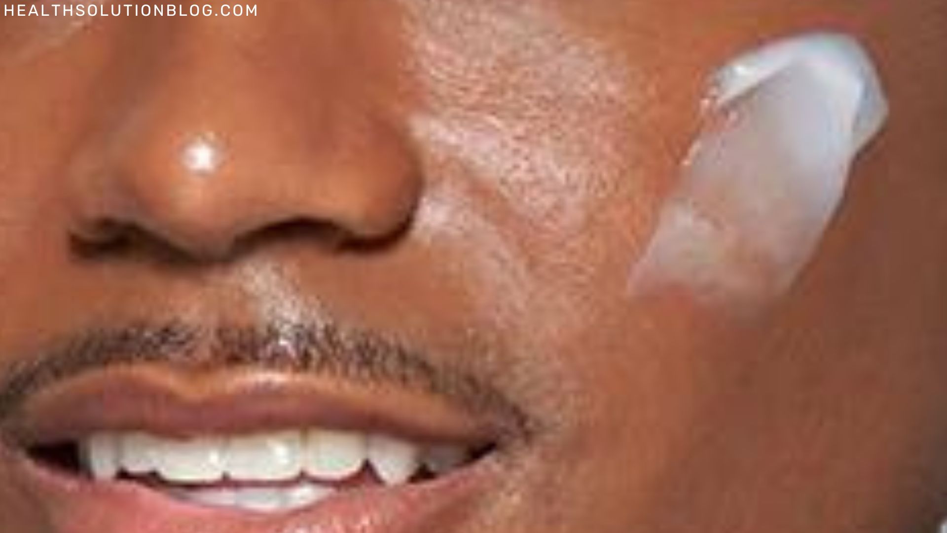 Top 18 Best Face Exfoliator For Black Skin Health solution blog