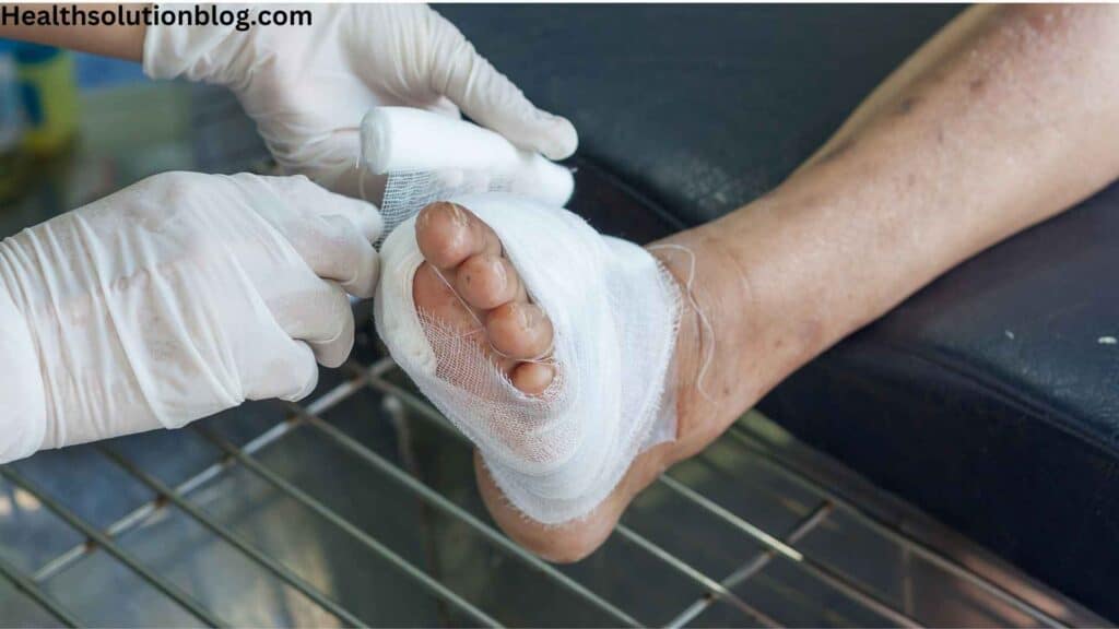 Diabetic foot bandage