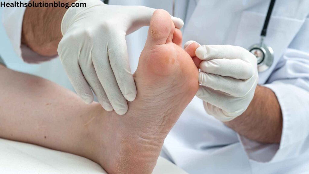 A doctor examing athelete's disease  toes