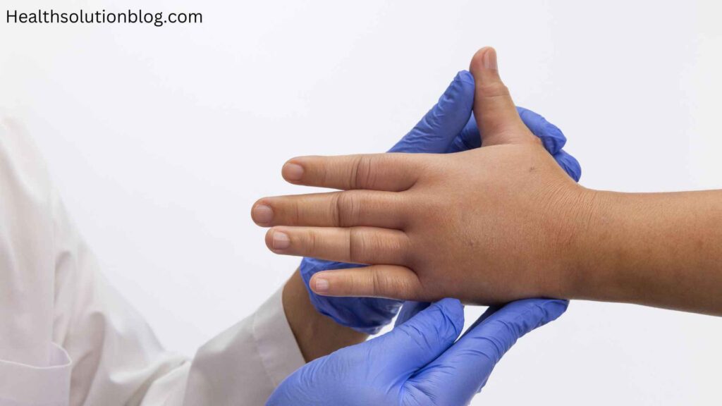 A physician checking the swelled and allergic hand of a boy