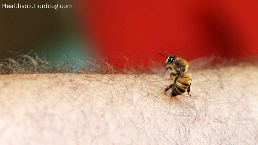 A bee sitting on arm for sting