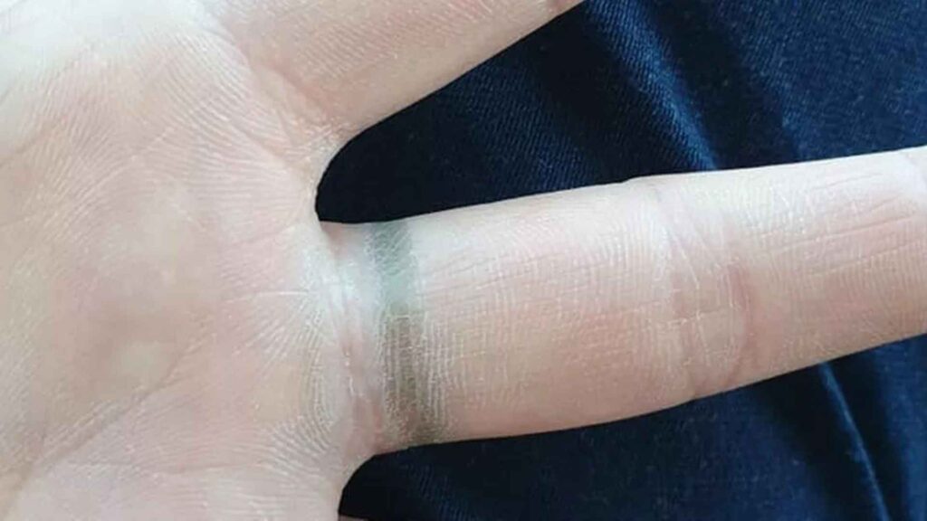 Finger ring turned finger green